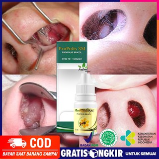 Obat Polip Hidung Sinusitis Hidung Bau Busuk Benjolan Di Dalam Hidung Pilek Menahun Shopee Indonesia