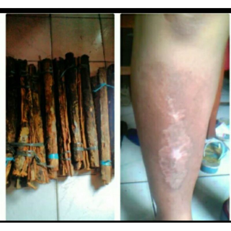 

500gram kayu raru herbal diabetes