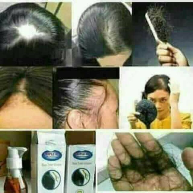 Triple Six Hair Tonic Ginseng Nasa