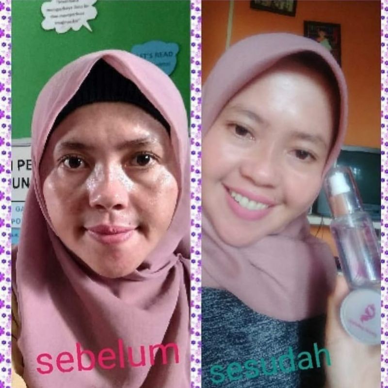 

JUSTMINBEAUTYSKINCARE