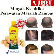 &quot;PROMO*HAPPY&quot;PAKET SHAMPO &amp; MINYAK KEMIRIKU PENGHILANG UBAN 100% ORIGINAL BPOM-C.O.D-MURAH