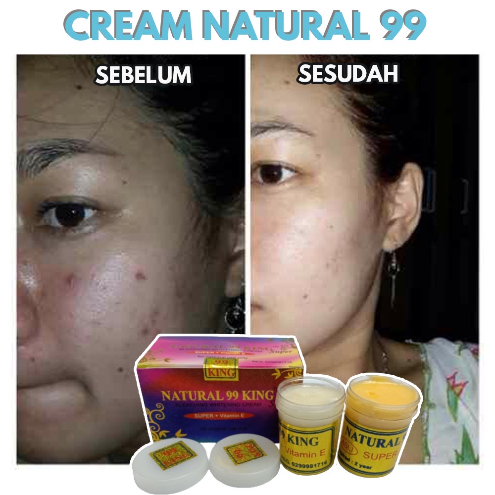 Cream Natural 99 / Krim Siang Dan Malam Original / Cream Wajah Vit E Memutihkan Dan Melembabkan Waja