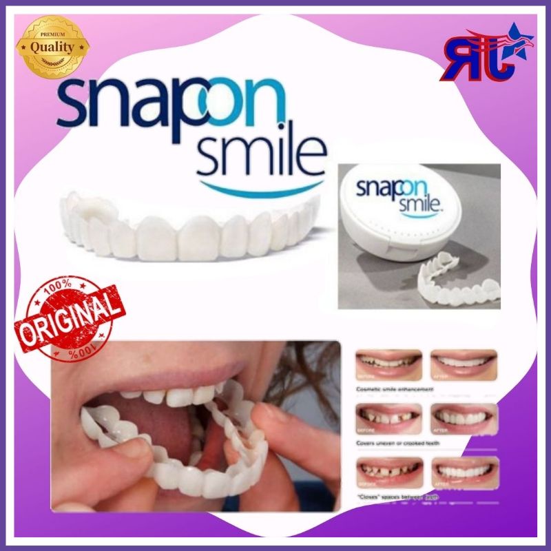 gigi palsu snap on smile 100%orginal authentic veneer inovatif murah Berkwalitas aman gigi tampal