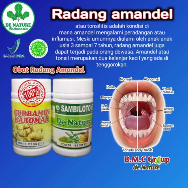 

Obat amandel, obat radang tenggorokan, obat radang amandel herbal De Nature