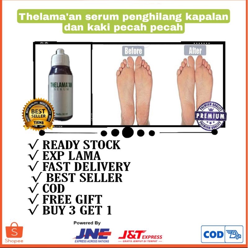 ORIGINAL THELAMA'AN SERUM obat kaki pecah pecah dan kapalan paling ampuh