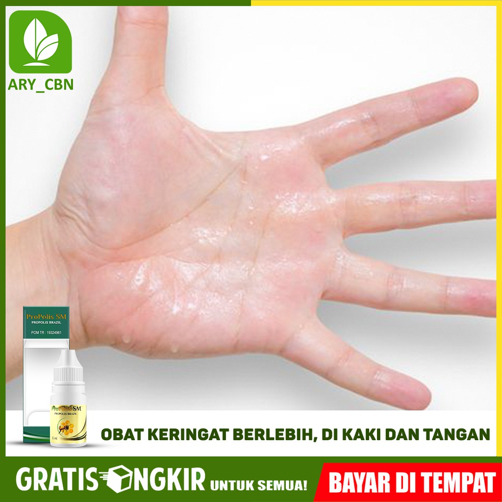 

Obat Keringat Di Kaki Dan Tangan Herbal Yang Aman Herbal Propolis SM Brasil Bisa COD Di Cirebon