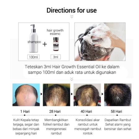 [BPOM] LANBENA Hair Growth Essential Oil & Care Essence Spray - Mencegah Kerontokan - 20mL-3