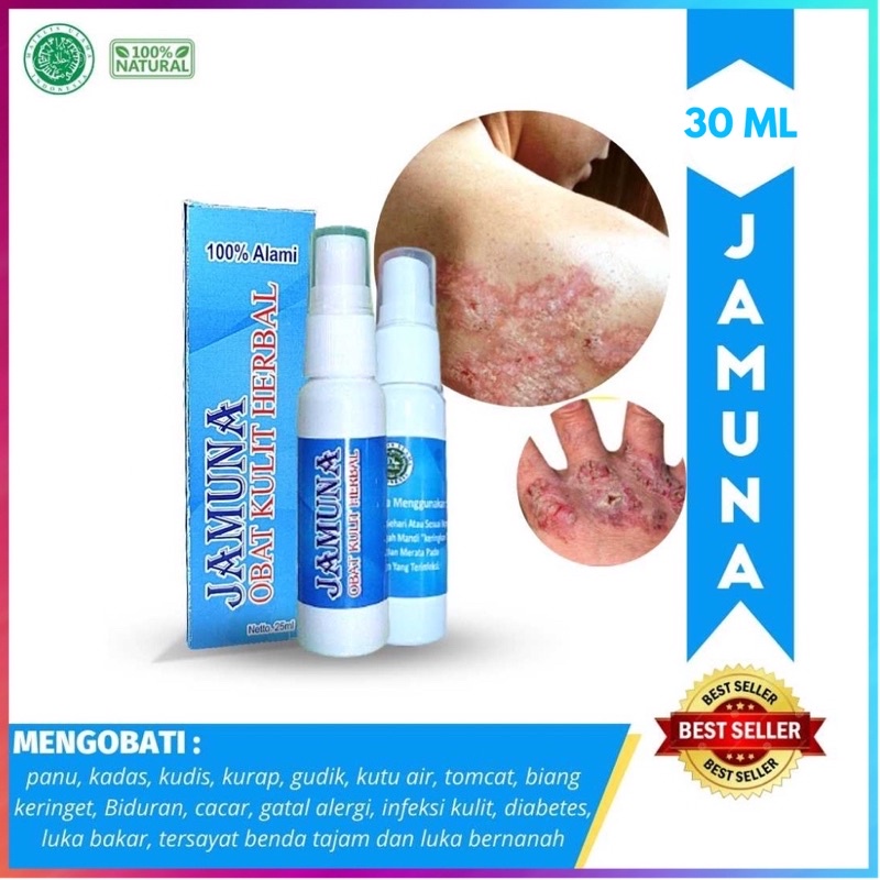 Obat Alergi Gatal Kulit Paling Ampuh Herbal Jamuna Spray Isi 30 ml | Obat gatal selangkangan eksim d