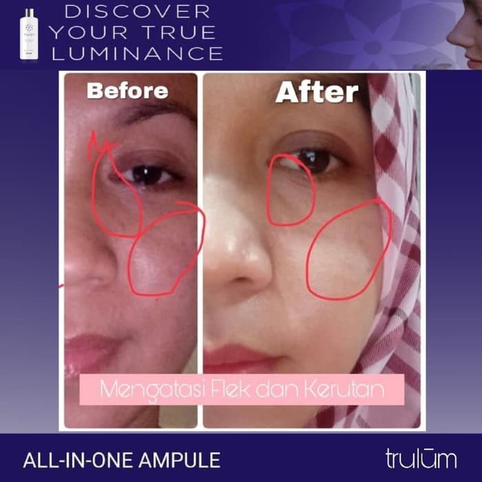 PAKET Serum Krim Cream Pemutih Wajah Terbaik Yang Ampuh Aman Dan Cepat