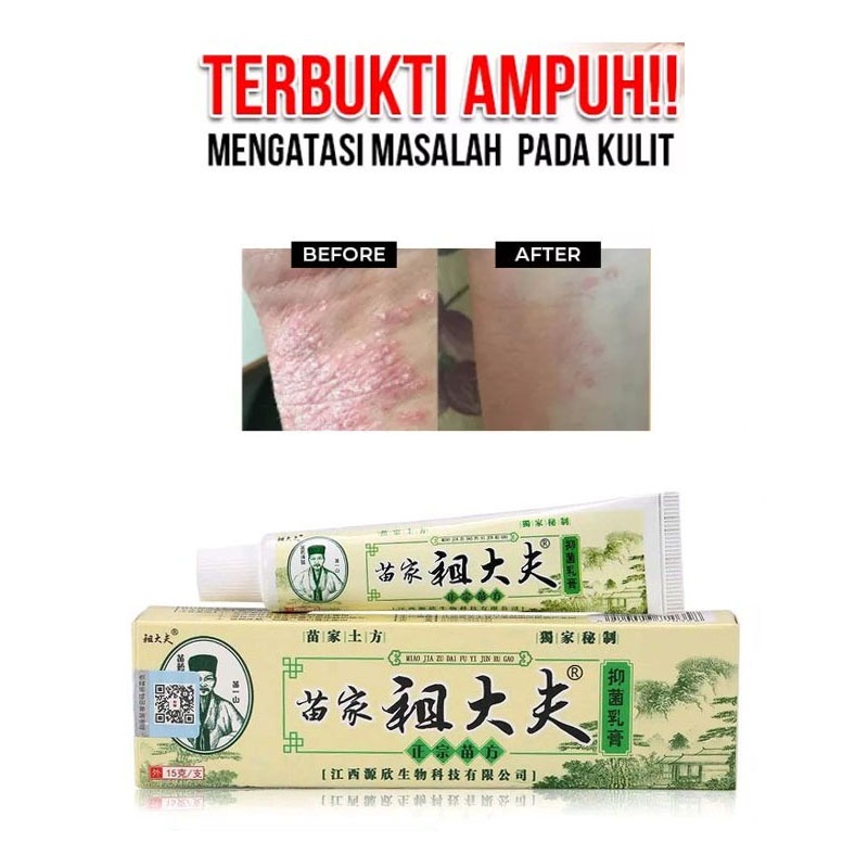 [BAYAR DITEMPAT] Yiganerjing Obat Eksim Gatal Jamur Alergi Herbal Antifungal Cream Psoriasis Vitiligo Skin / Obat Gatal Kudis Kurap Panu Kutu Air Ampuh Salep Penghilang Bekas Luka Obat Belang Putih di Kulit