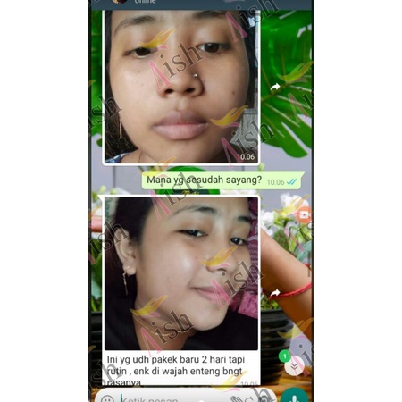 AISH SERUM KOREA ( SERUM GLOWING )