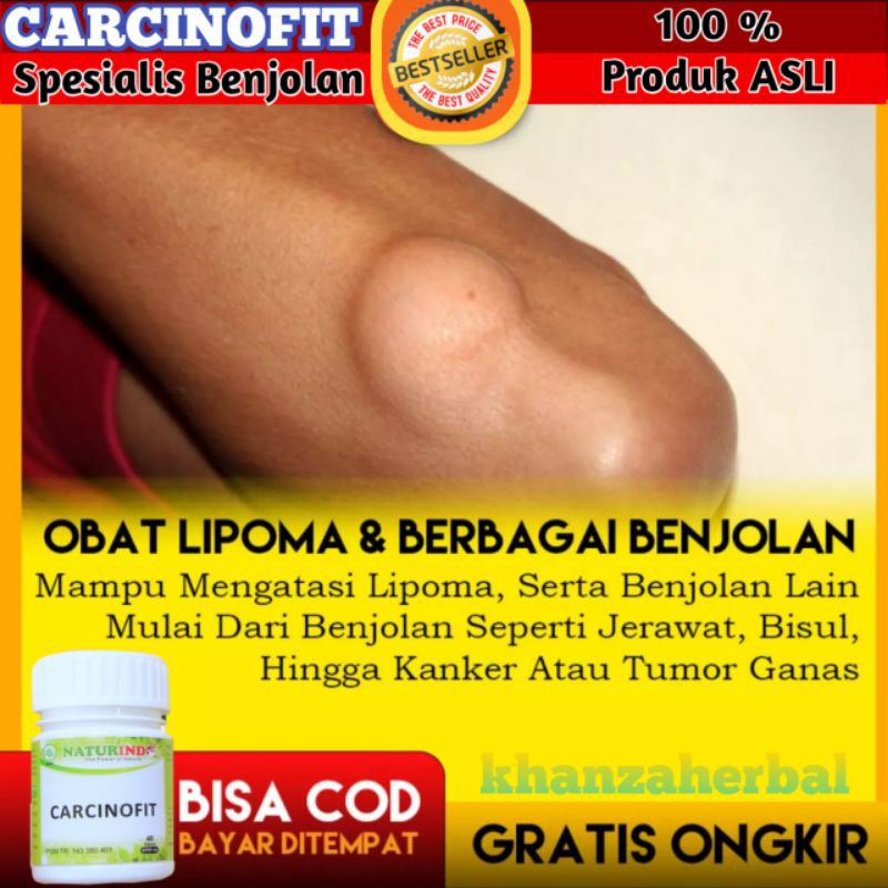 OBAT HERBAL BENJOLAN KANKER TUMOR BISUL JERAWAT BATU LIPOMA UCI UCI HERBAL CARCINOFIT NATURINDO COD-5