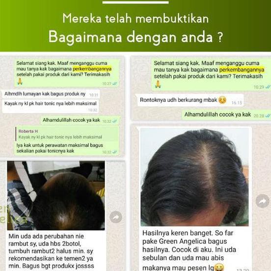 Suplemen Penumbuh Rambut Cepat Wanita Dan Pria Secara Alami Dan Aman Shopee Indonesia