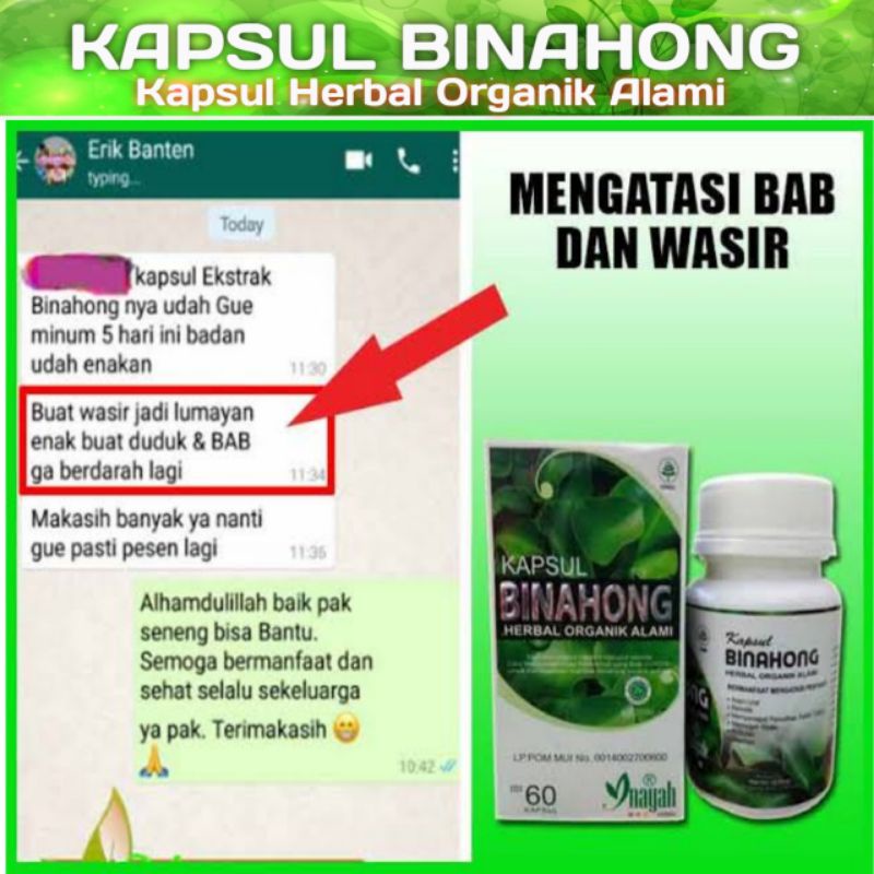 

DAUN BINAHONG KAPSUL WASIR PENYEMBUH LUKA INAYAH