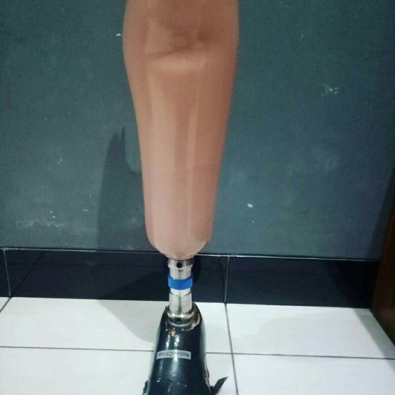 Kaki Palsu Bawah Lutut (Transtibial)