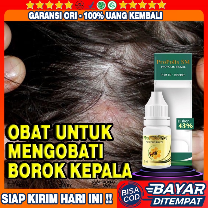 Obat Borok Kepala, Jamur Kepala, Infeksi Kepala Bernanah, Borok Kepala, Ketombe Parah Dan Gata Gatal