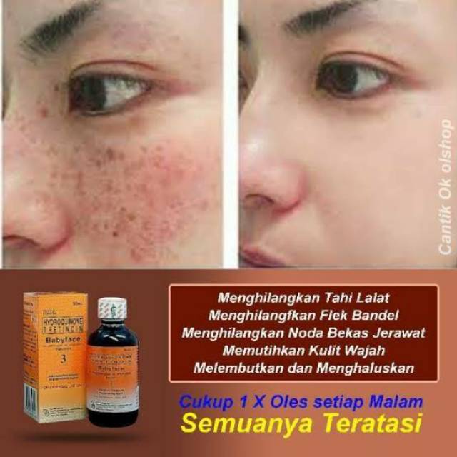 TONER RDL / RDL TONER / BABYFACE RDL