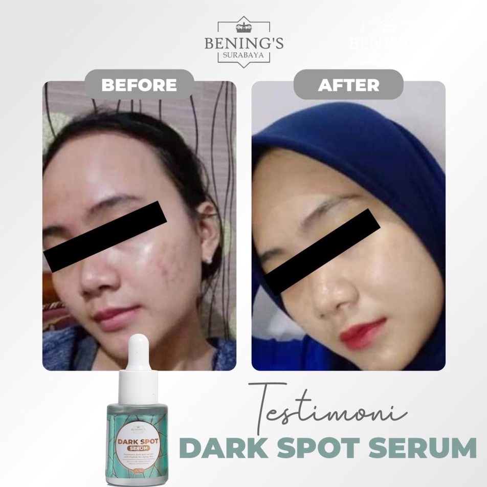 SERUM DARK SPOT BENING SKINCARE DR OKY PRATAMA  MENGATASI FLEK MELASMA MENCERAHKAN