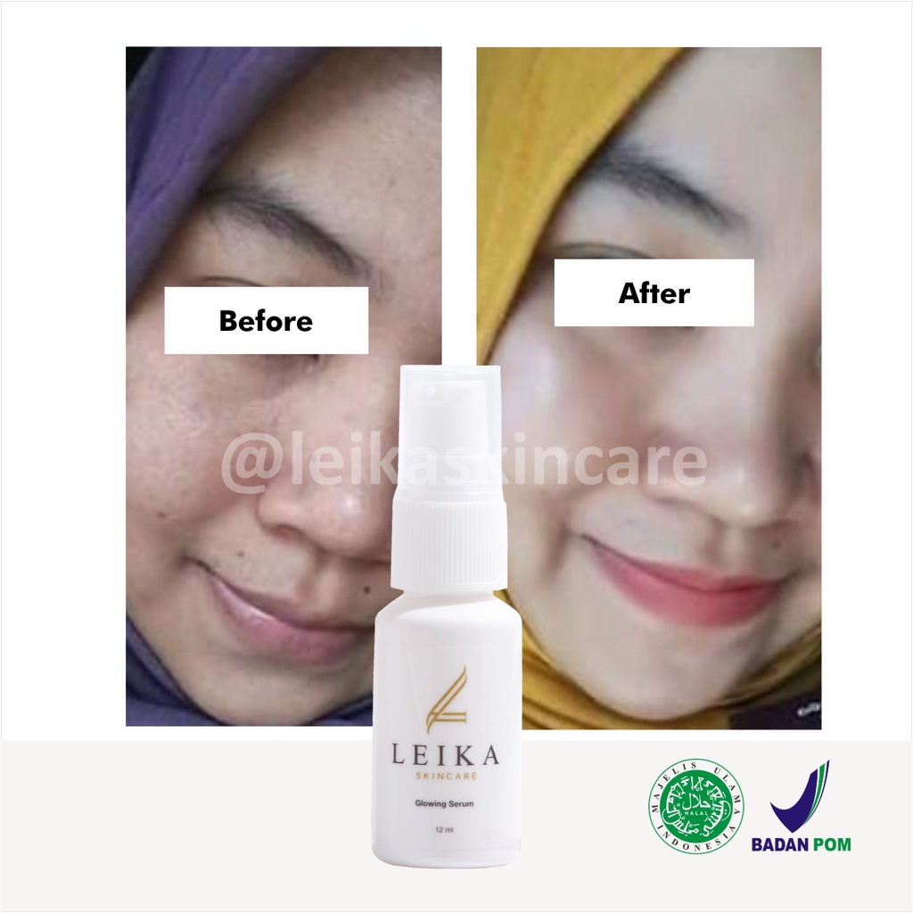 Ampuh! Pelembab Wajah untuk Kulit Wajah Kering dan Kusam Ampun BPOM Pelembab untuk Wajah Buat Kulit Normal Sensitif Glowing Serum Leika Skincare 12ml Asli HALAL MUI Resmi BPOM