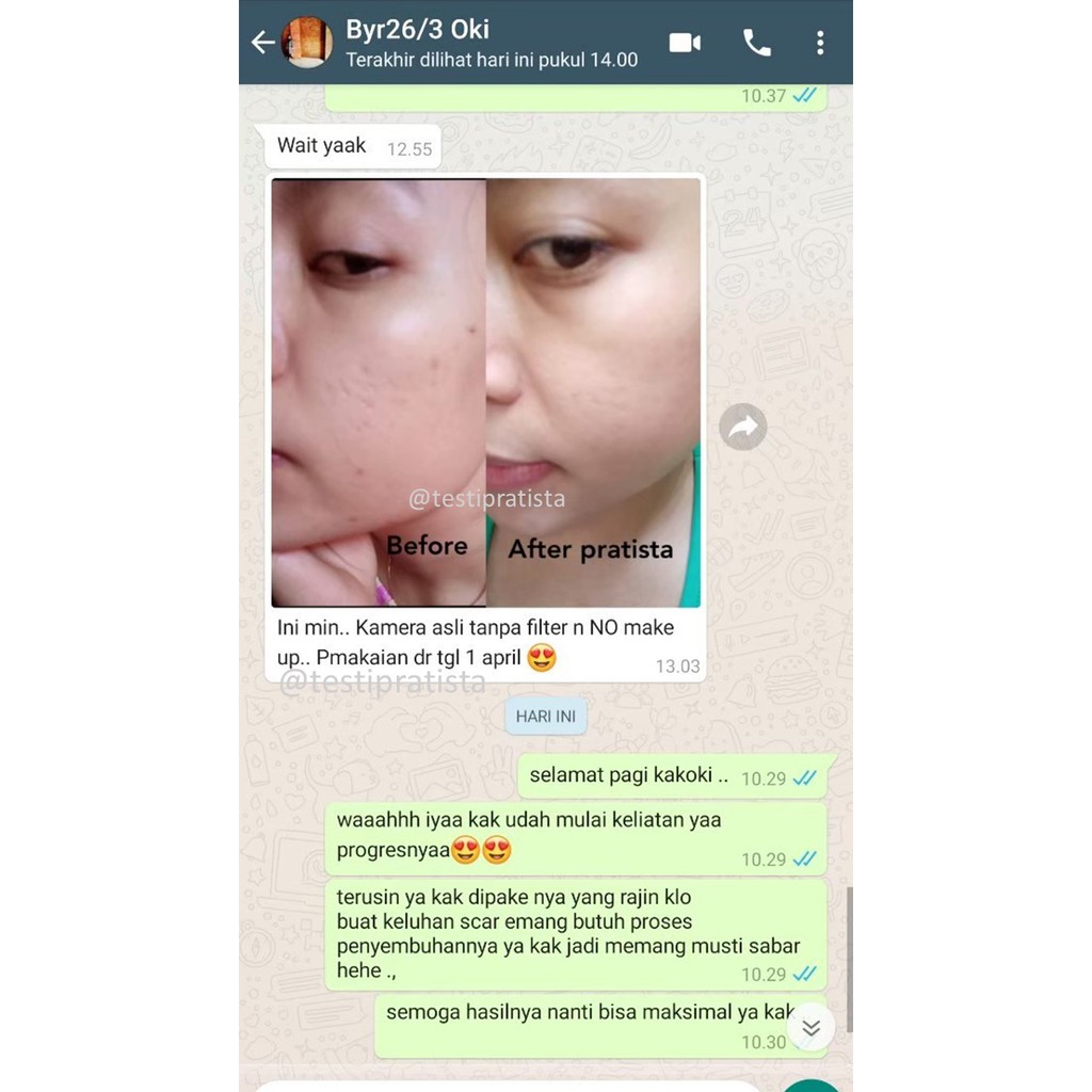 Centella Enrich Cream Men : Membantu Merawat Kulit Bopeng Untuk Pria