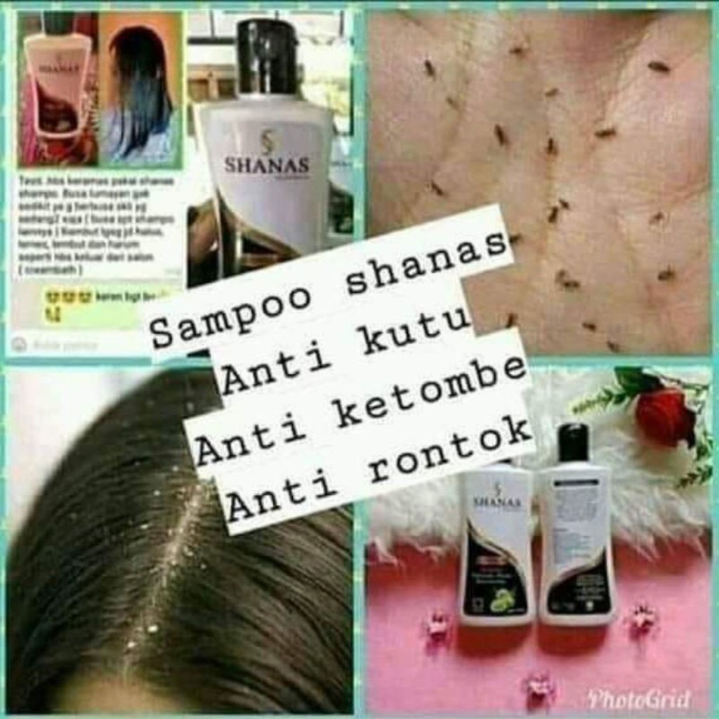 Shampo Penghilang Kutu Rambut &amp; Telurnya Shampo Anti Rontok Sampo Penghilang Kutu Rambut Shanas