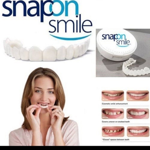 Snap On Smile Veneer Instan Gigi Palsu Tiruan Kesehatan Mulut Mouth Ok