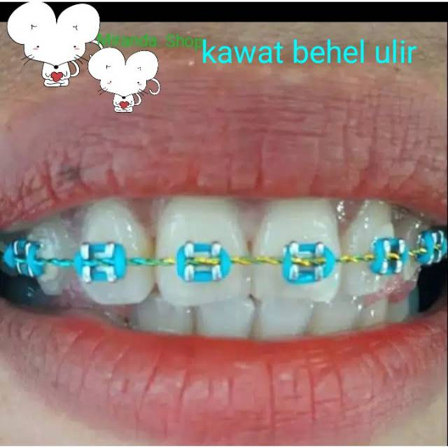 Kawat behel ulir warna warni. 1 pc = 15 cm