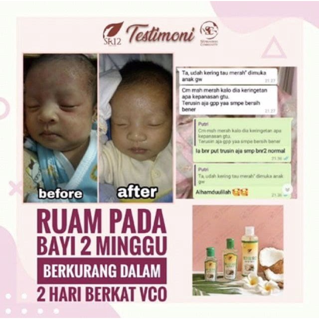 SR12 VCO Virgin Coconut Oil Suplemen Kesehatan Vitamin Busui Herbal Minyak Kelapa Natural Untuk Rambut Pelembab Kulit Kering BPOM