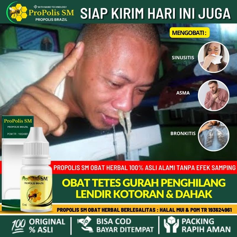 Obat Tradisional Untuk Sinusitis Anak & Dewasa, Solusi Atasi Hidung Berbau Busuk Dengan Gurah,Obat H