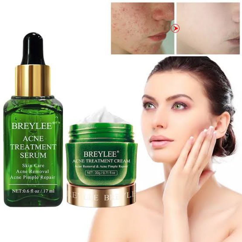 Jual BREYLEE Serum Acne Treatment + Face Cream Anti Acne (2pcs