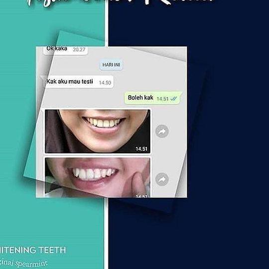 ۝ SUPER WHITENING TEETH ORIGINAL / TIENS ORECARE ♢