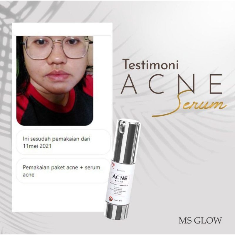 SERUM MS GLOW / SERUM LUMINOUS MS GLOW / SERUM LIFTHING MS GLOW / SERUM ACNE / GOLD SERUM WAJAH