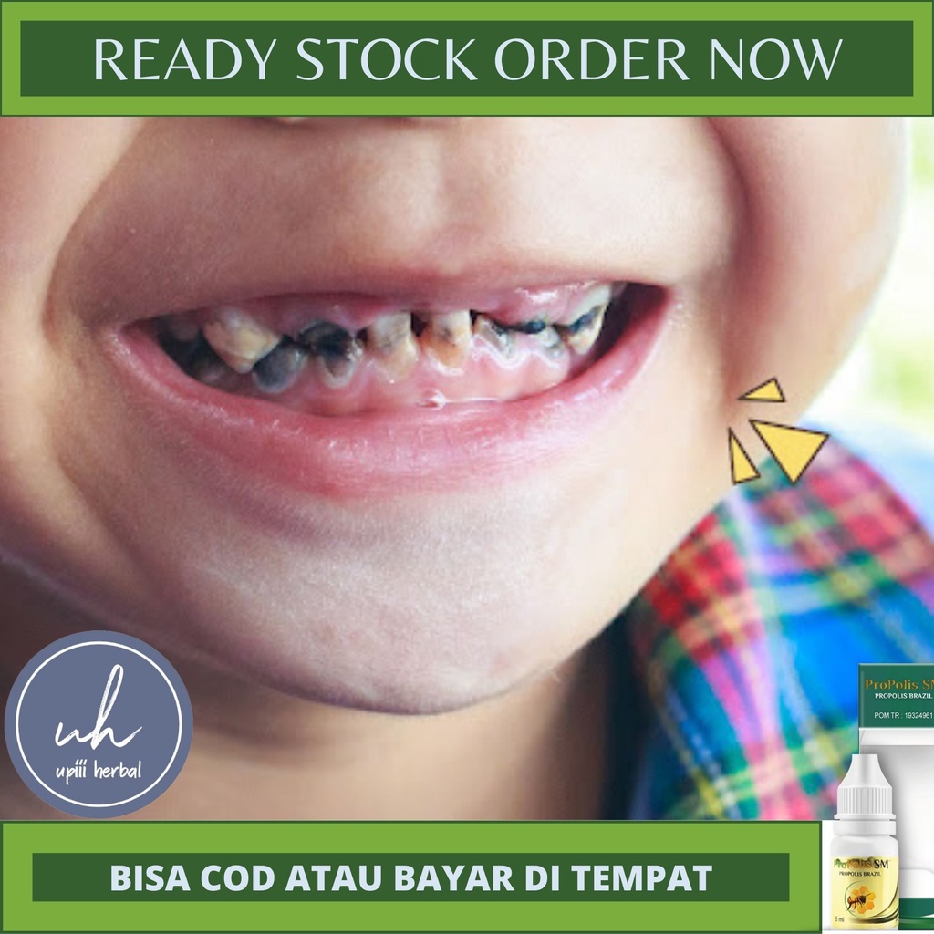 OBAT GIGI, OBAT UNTUK GIGI KEROPOS, OBAT GIGI HITAM, OBAT GIGI BERLUBANG, OBAT SAKIT GIGI, OBAT GIGI