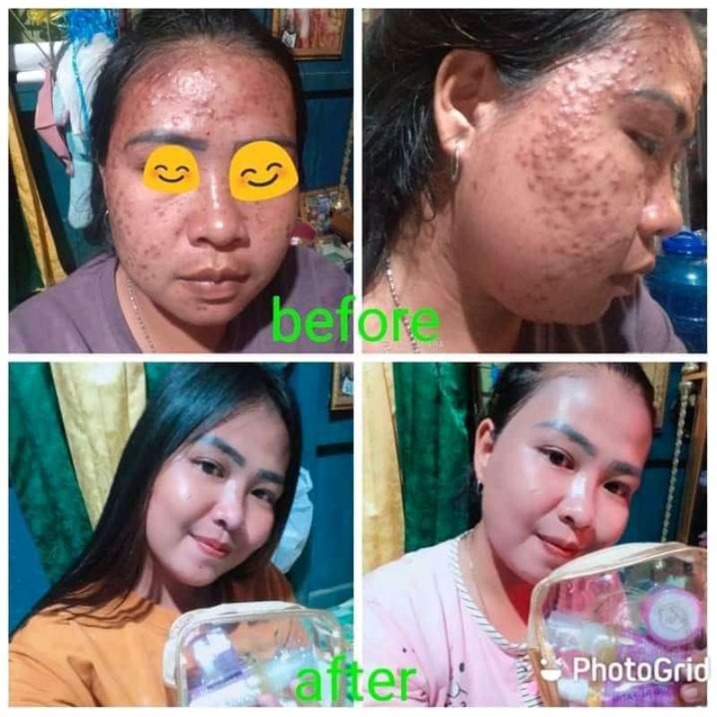 UBC SKINCARE PAKET KOMPLIT UMI BEAUTY CARE