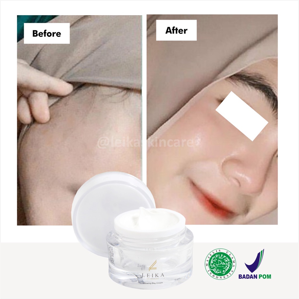 Menakjubkan! Krim Pelembab Wajah Kering dan Berminyak [Ampuh!] Cream Pelembab Wajah Jerawat jadi Glowing / Glowing Day Cream Leika Skincare 10gr Cream Pelembab Glowing Aman Ampuh Original BPOM Halal MUI