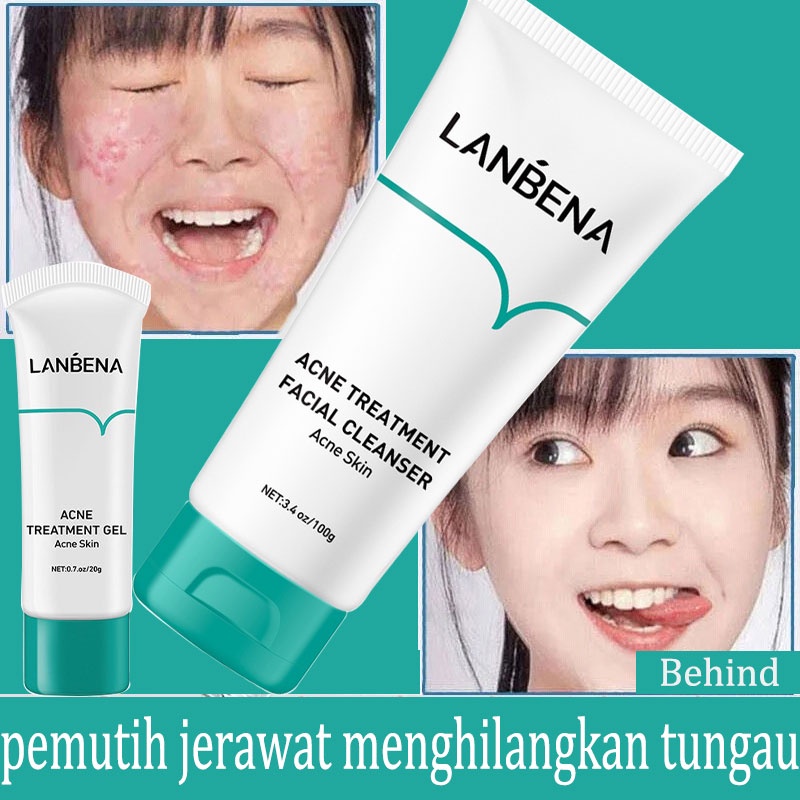 [BPOM] LANBENA Oligopeptide  ponds sabun Jerawat alat Jerawat pembersih wajah  muka make up wajah pria wanita alat pembersih wajah pemutih pembersih muka ponds Oil Control Skin Acne Treatment 100g