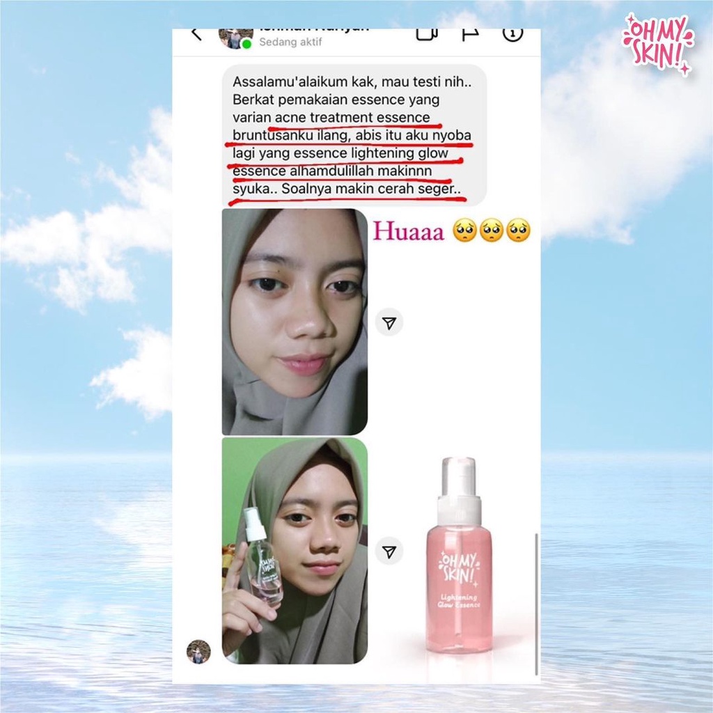 ESSENCE LIGHTENING GLOW &amp; ACNE REAPAIRING ESSENCE OhMySkin [DIST RESMI] Essence Wajah 60ml