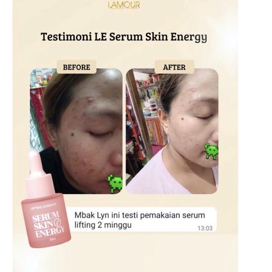 

Paling Diminati.. Lifting Essence Serum Skin energy,Packing Aman dengan bubblewrap