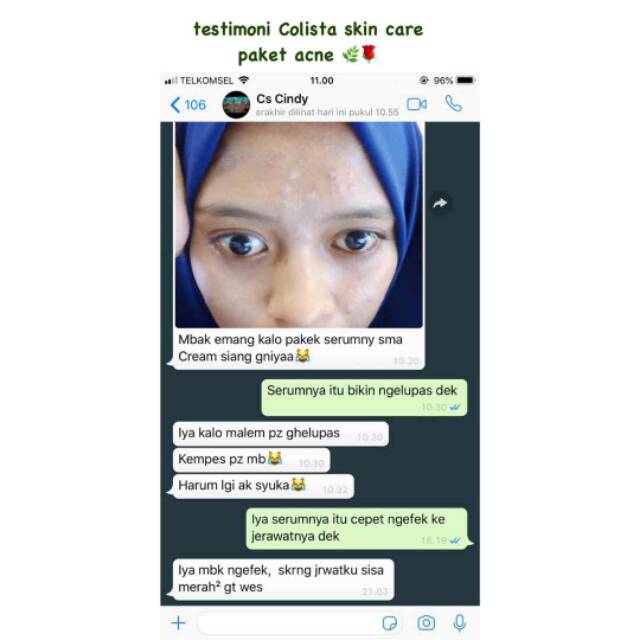 colista skincare acne