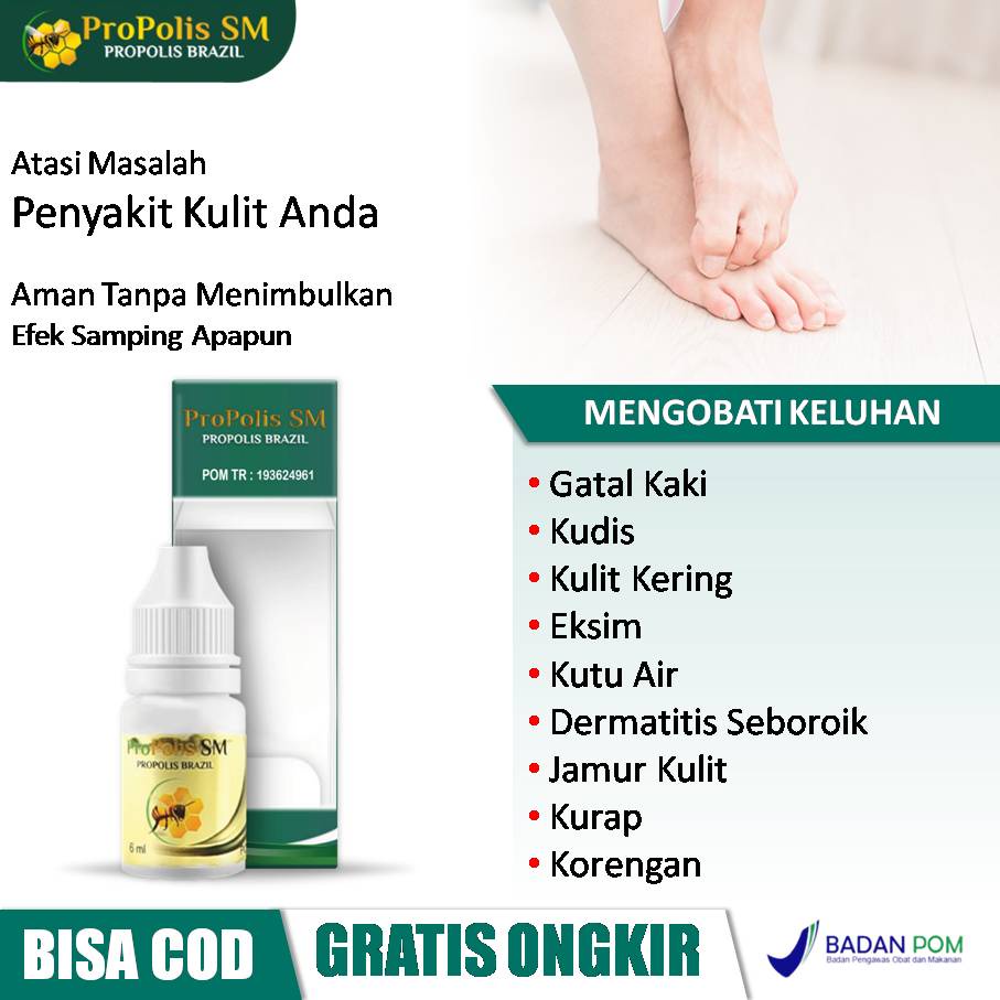Obat Gatal Kaki, Kudis, Kulit Kering, Eksim, Kutu Air, Dermatitis Seboroik, Jamur Kulit, Korengan, K
