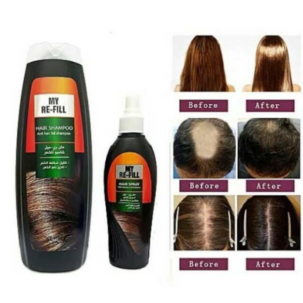 My Way Refill & Nature's Shampoo Perawatan Rambut Rontok