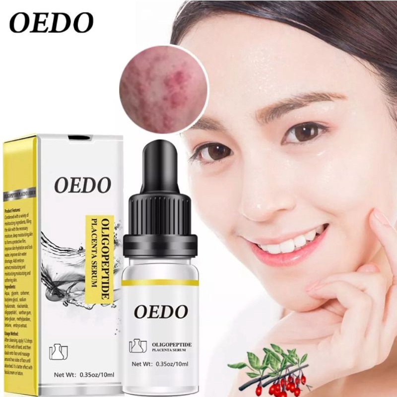 OEDO OLIGOPEPTIDE PLACENTA SERUM FACE CREAM ACNE TREATMENT SKIN CARE REPAIR WHITENING ANTI AGING WINKLES ESSENCE