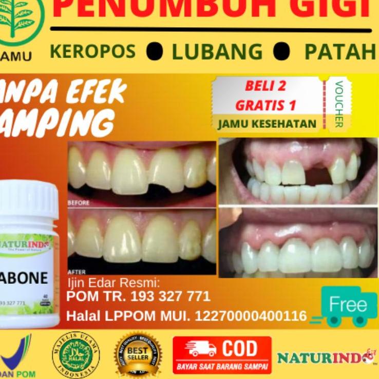 4.4 TERLARIS Obat Penumbuh Gigi Herbal Dewasa Dan Anak Penguat Gigi Goyang Gigi Ompong Berlubang Ker