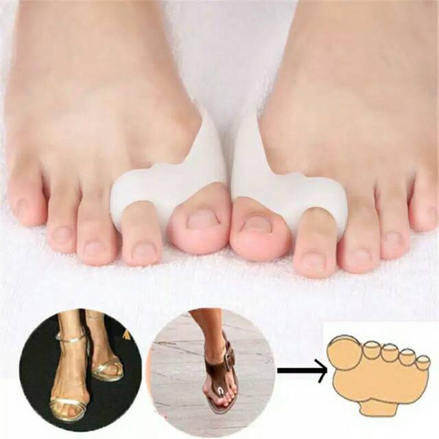 (Original) ALAT PEMISAH JARI JEMPOL KAKI BUNION / HALLUX VALGUS Exp Lama Termurah