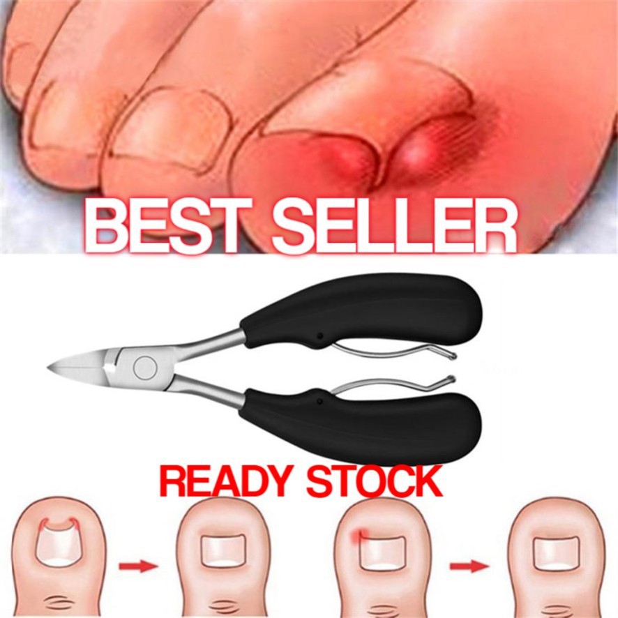 Tegoni Gunting Kuku Jempol Kaki Anti Cantengan