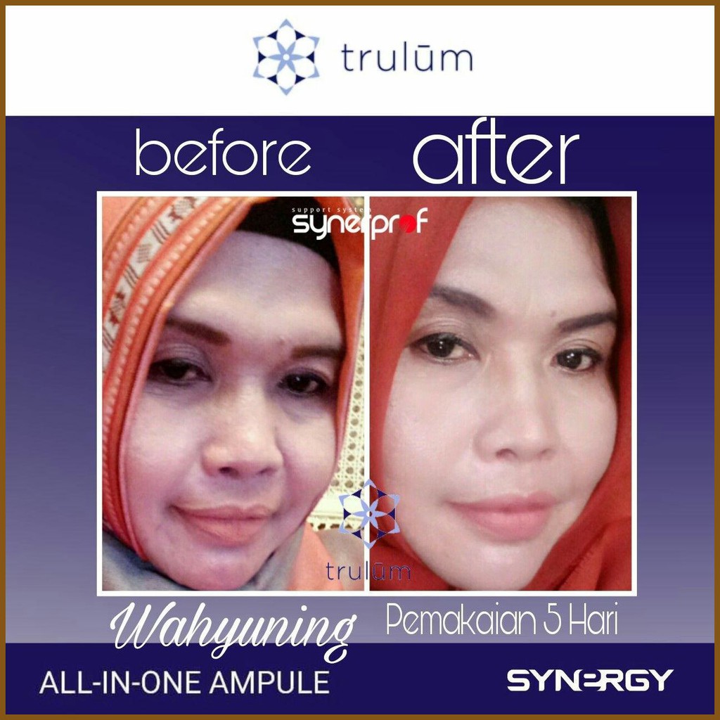 @733¯ Cream Wajah Yg Aman Untuk Ibu Menyusui - Cream Pemutih Wajah Dan Glowing Trulum