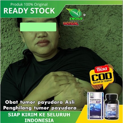 Obat Tumor payudara Asli, Penghilang tumor payudara, tumor payudara 100% asli original, Menghilangka