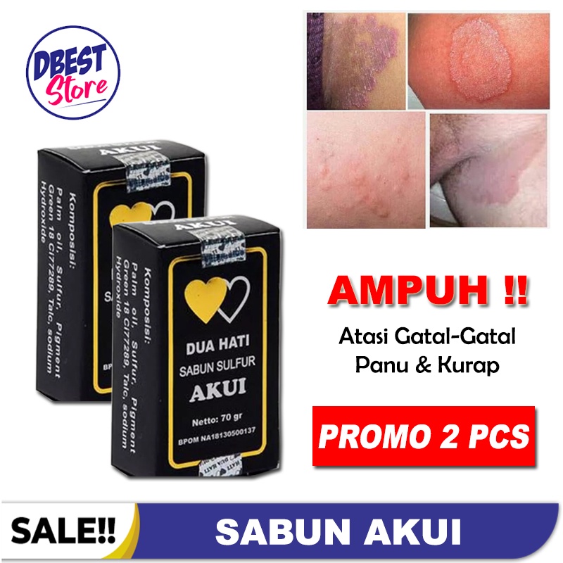 [COD] Akui Sabun Belerang Asli Obat Panu Obat Penyakit Kulit Obat Gatal Original BPOM