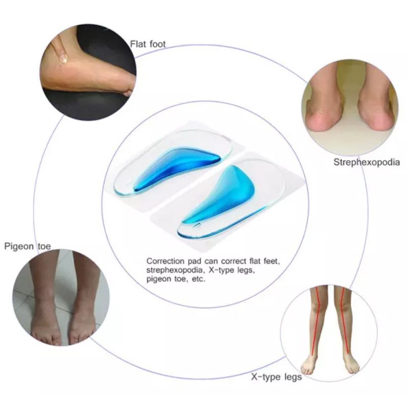 Insole Flat Foot Insole Kaki Datar Arch Support flat foot silicone gel silikon insole