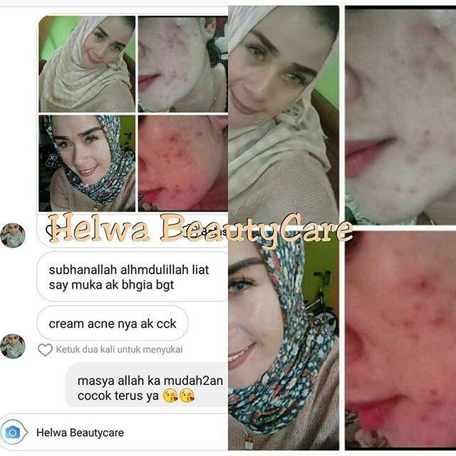 Helwa beautycare